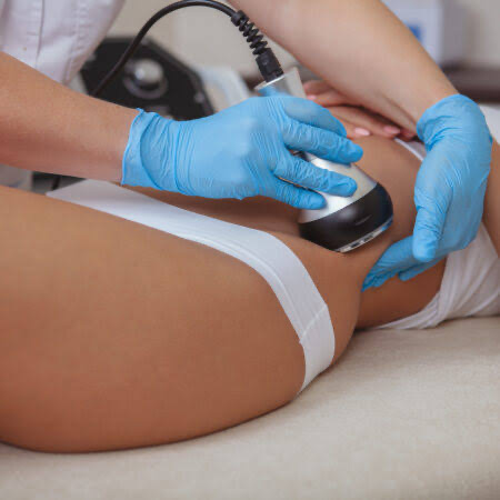Cavi Lipo body contouring treatment